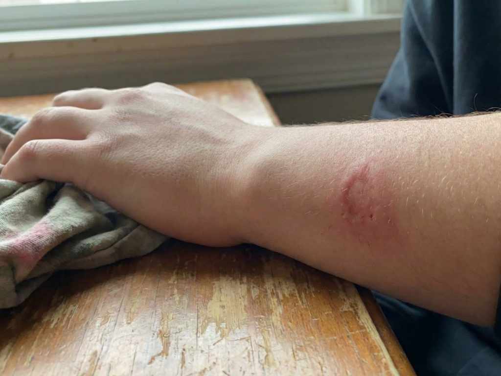 تفسير حلم العض من شخص غير معروف